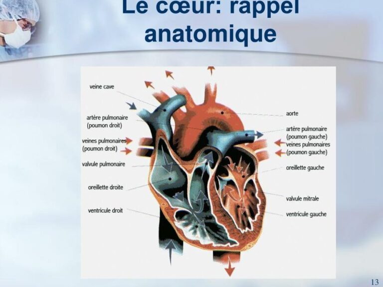 Comprendre la classification de Carpentier des maladies valvulaires ...