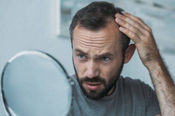causes chute de cheveux