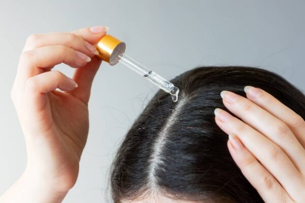 déclencheurs chute de cheveux