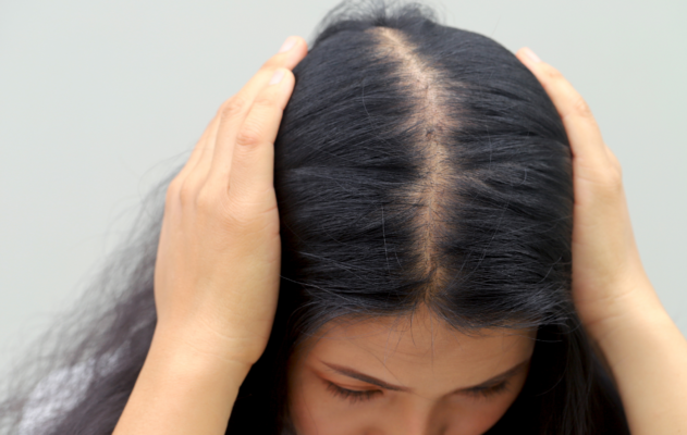 chute cheveux